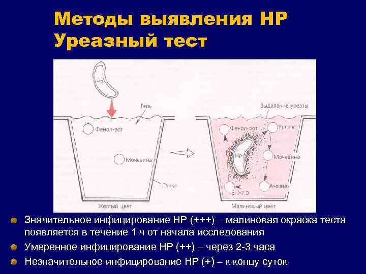 Методы выявления HР Уреазный тест Значительное инфицирование НР (+++) – малиновая окраска теста появляется