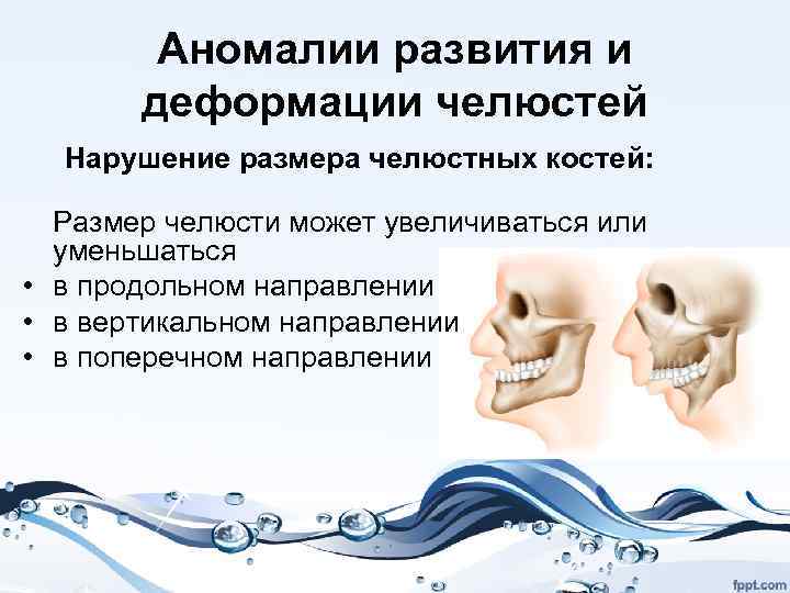 Оперативное лечение при аномалиях и деформациях верхней челюсти презентация