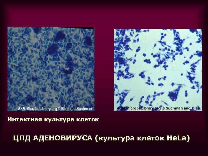 Интактная культура клеток ЦПД АДЕНОВИРУСА (культура клеток He. La) 