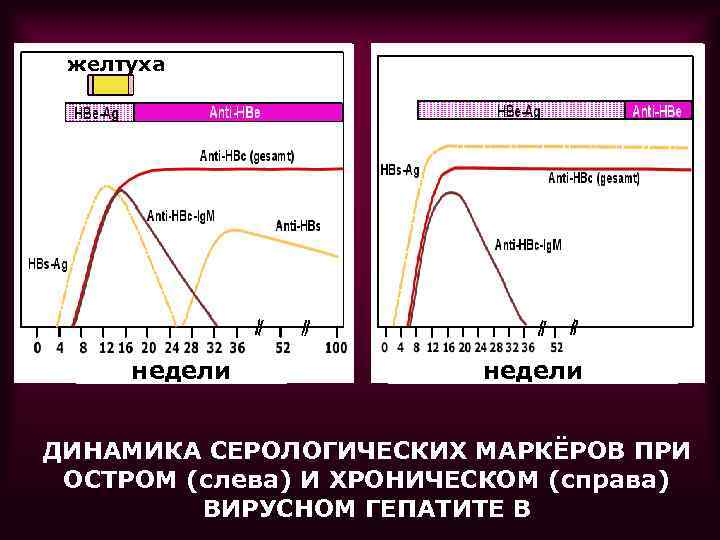 желтуха недели ДИНАМИКА СЕРОЛОГИЧЕСКИХ МАРКЁРОВ ПРИ ОСТРОМ (слева) И ХРОНИЧЕСКОМ (справа) ВИРУСНОМ ГЕПАТИТЕ В