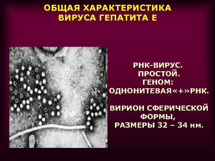 ОБЩАЯ ХАРАКТЕРИСТИКА ВИРУСА ГЕПАТИТА Е РНК-ВИРУС. ПРОСТОЙ. ГЕНОМ: ОДНОНИТЕВАЯ «+» РНК. ВИРИОН СФЕРИЧЕСКОЙ ФОРМЫ,