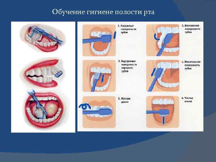 Обучение гигиене полости рта 