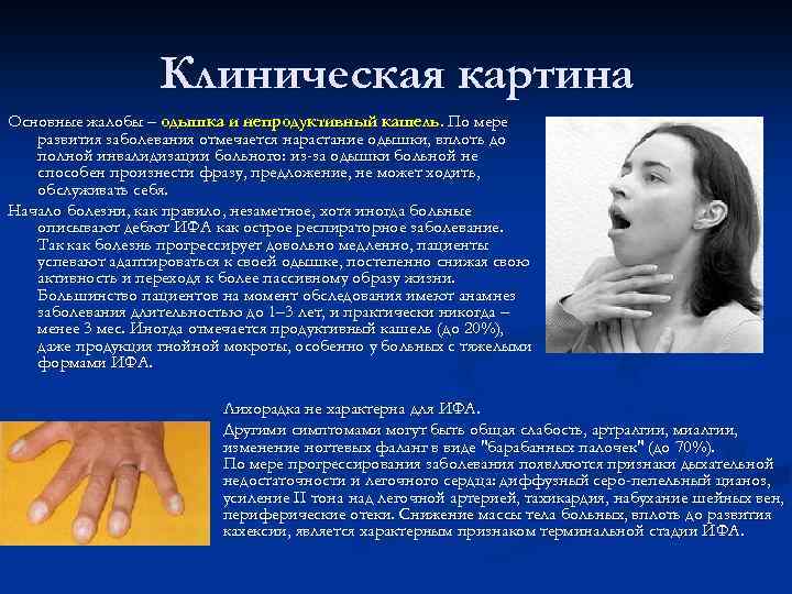 Клиническая картина Основные жалобы – одышка и непродуктивный кашель. По мере развития заболевания отмечается