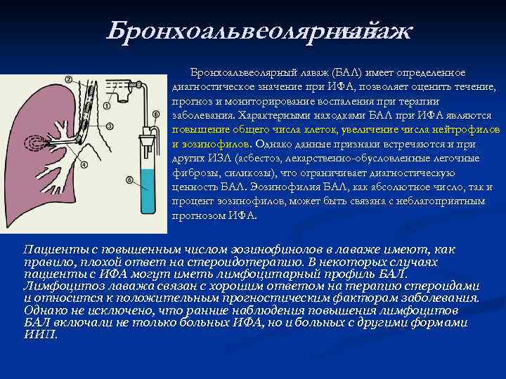 Бронхоальвеолярный лаваж (БАЛ) имеет определенное диагностическое значение при ИФА, позволяет оценить течение, прогноз и
