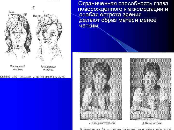  • Ограниченная способность глаза новорожденного к аккомодации и слабая острота зрения делают образ