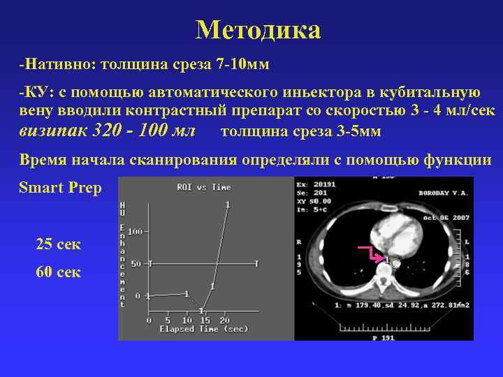 Методика -Нативно: толщина среза 7 -10 мм -КУ: с помощью автоматического иньектора в кубитальную