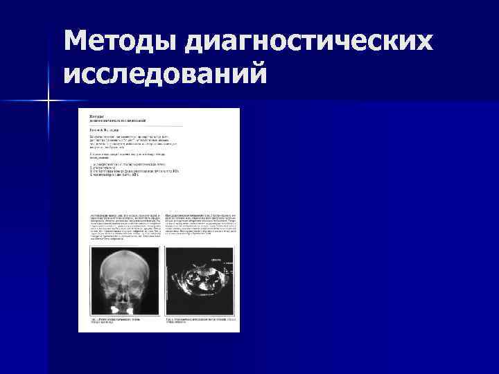 Методы диагностических исследований 