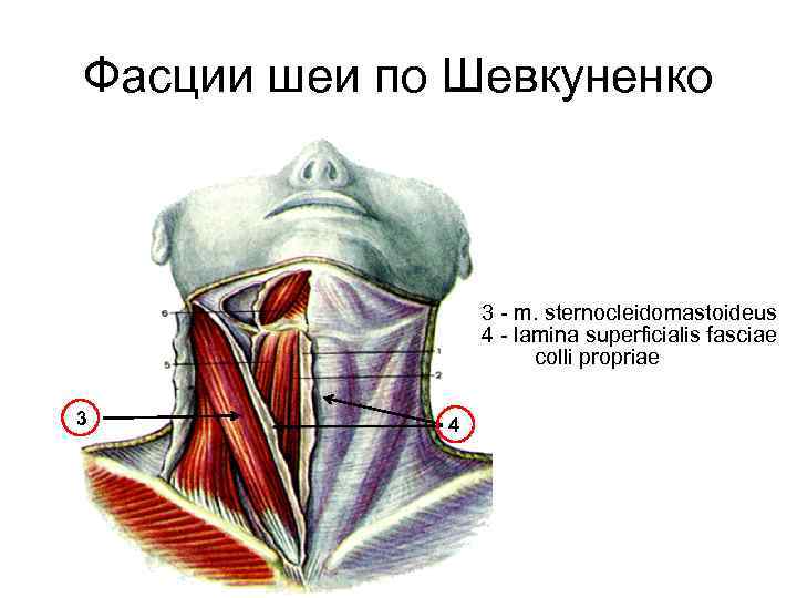Фасции шеи по Шевкуненко 3 - m. sternocleidomastoideus 4 - lamina superficialis fasciae colli