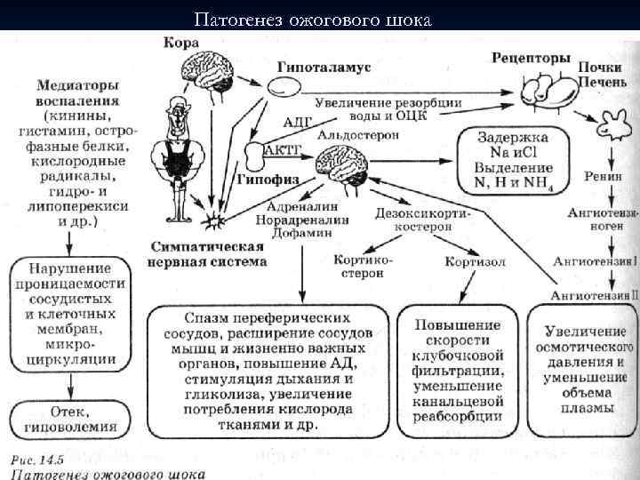 Ожоговый шок патогенез схема