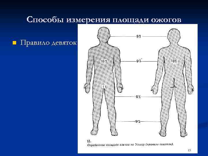 Способы измерения площади ожогов n Правило девяток 