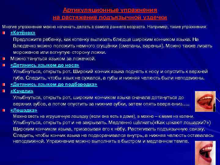 Артикуляционные упражнения на растяжение подъязычной уздечки Многие упражнения можно начинать делать с самого раннего