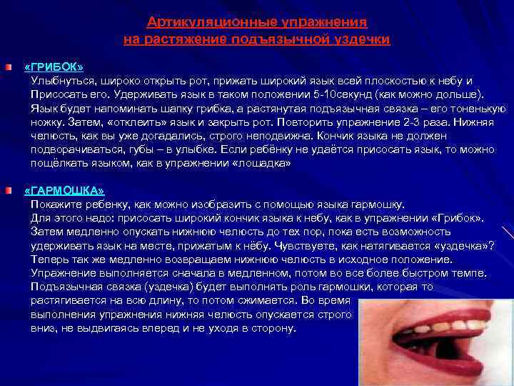 Артикуляционные упражнения на растяжение подъязычной уздечки «ГРИБОК» Улыбнуться, широко открыть рот, прижать широкий язык