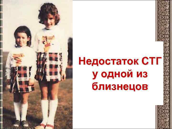 Недостаток СТГ у одной из близнецов 
