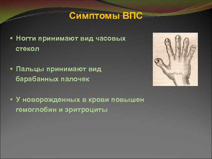 Симптомы ВПС § Ногти принимают вид часовых стекол § Пальцы принимают вид барабанных палочек