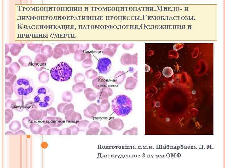 Гемобластозы патологическая анатомия презентация