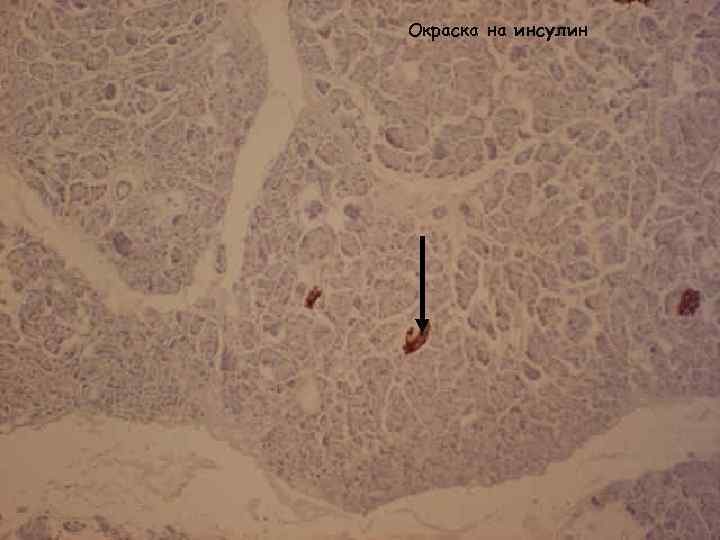 Окраска на инсулин 