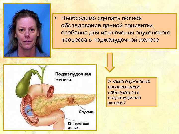  • Необходимо сделать полное обследование данной пациентки, особенно для исключения опухолевого процесса в