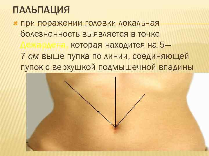 Находится выше. Болезненность в пупочной области. Болит пупок при пальпации. При пальпации живота боль вокруг пупка. Болезненность около пупка при пальпации.