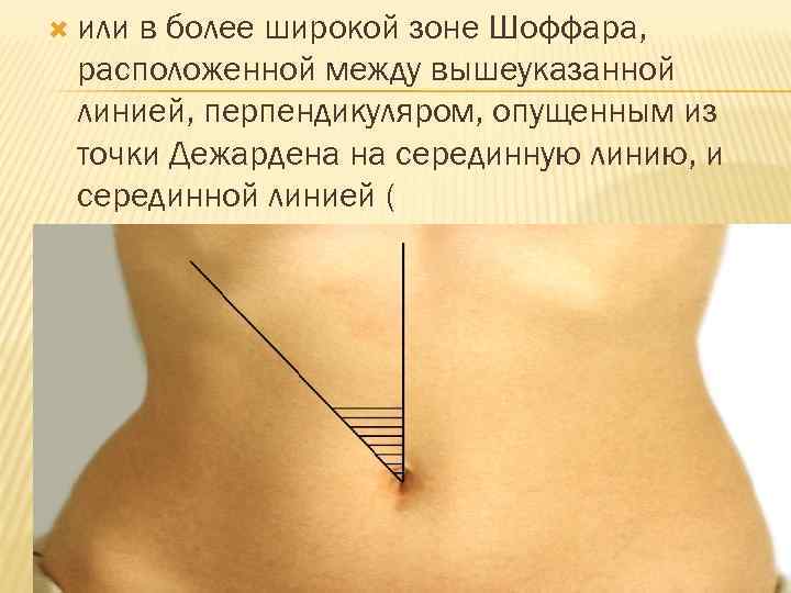  или в более широкой зоне Шоффара, расположенной между вышеуказанной линией, перпендикуляром, опущенным из