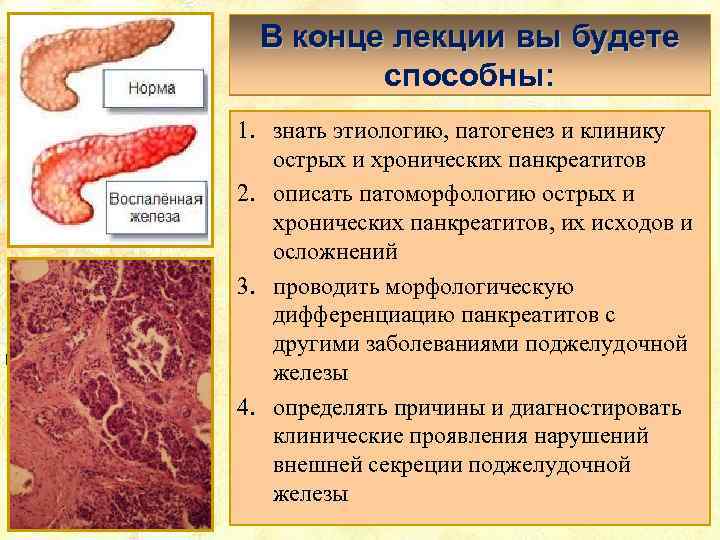 В конце лекции вы будете способны: 1. знать этиологию, патогенез и клинику острых и