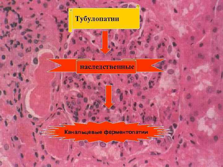 Тубулопатии наследственные Канальцевые ферментопатии 
