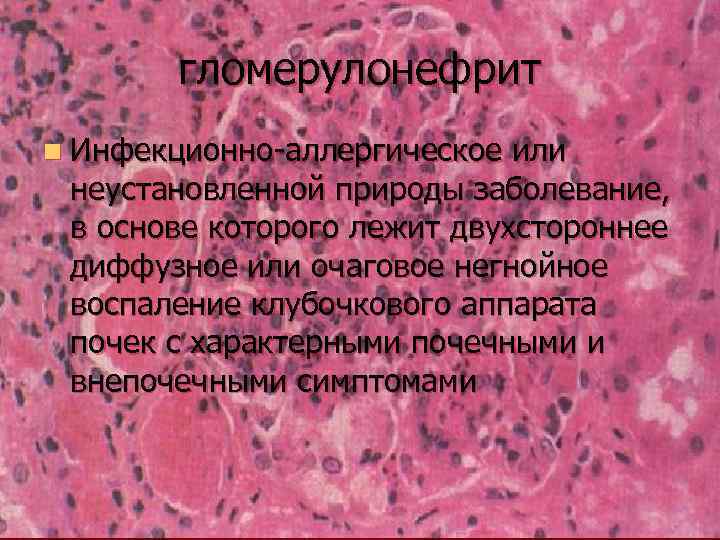 гломерулонефрит n Инфекционно-аллергическое или неустановленной природы заболевание, в основе которого лежит двухстороннее диффузное или