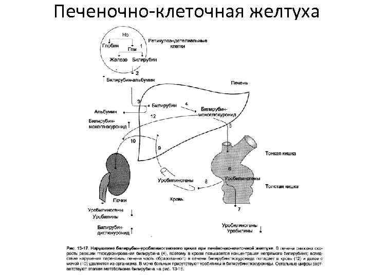 Печеночно-клеточная желтуха 