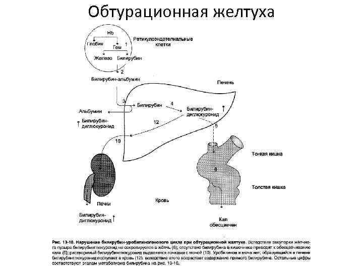 Обтурационная форма рака