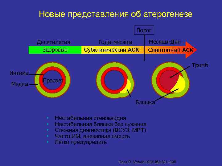 Новые представления об атерогенезе Порог Десятилетия Здоровые Годы-месяцы Субклинический АСК Месяцы-Дни Симптомный АСК Тромб