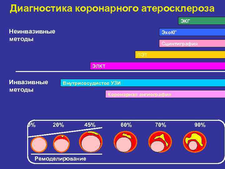 Диагностика коронарного атеросклероза ЭКГ Неинвазивные методы Эхо. КГ Сцинтиграфия ПЭТ ЭЛКТ Инвазивные методы 0%