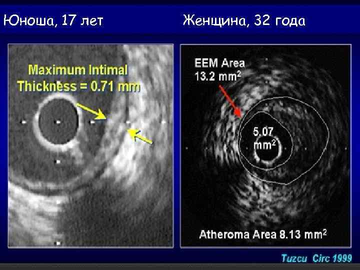 Юноша, 17 лет Женщина, 32 года 