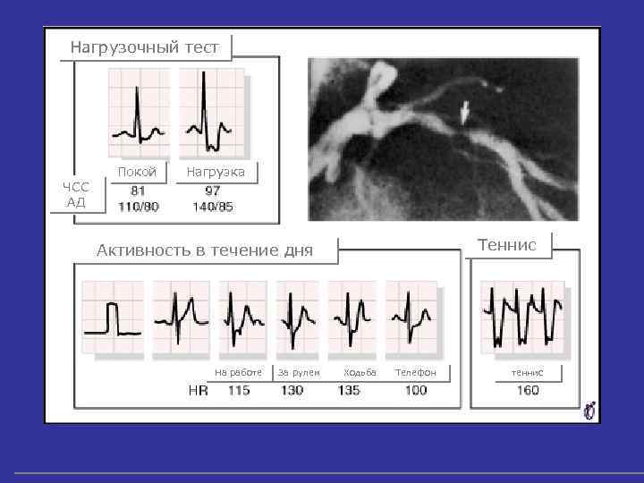 Нагрузочный тест Покой Нагрузка ЧСС АД Теннис Активность в течение дня На работе За