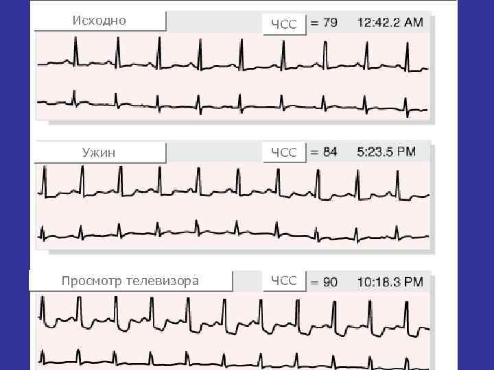 Исходно ЧСС Ужин ЧСС Просмотр телевизора ЧСС 