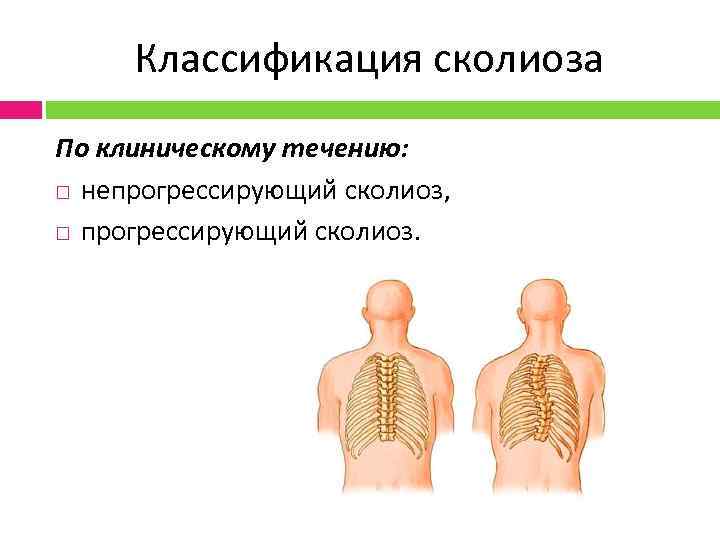 В каких плоскостях бывает ротация сколиоза