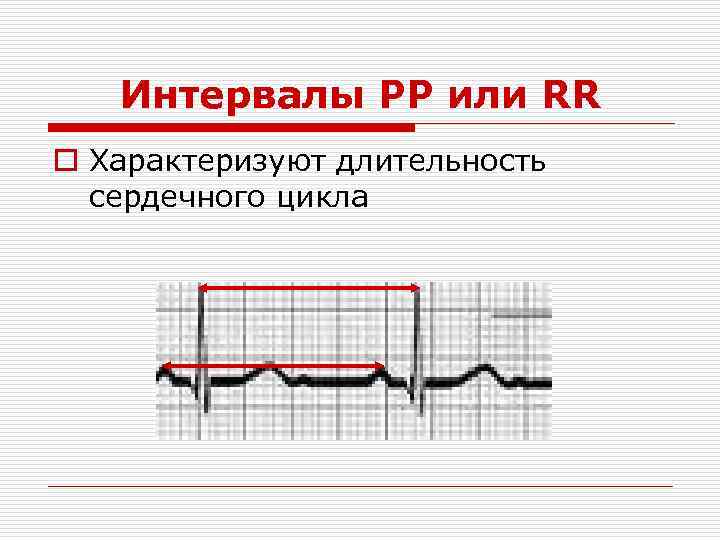Интервалы PP или RR o Характеризуют длительность сердечного цикла 