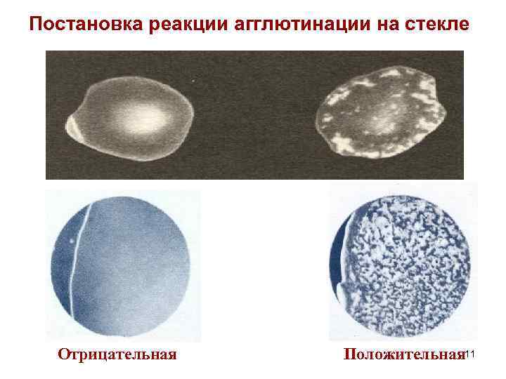 Реакция на стекло. Реакция агглютинации на стекле микробиология. Постановка ориентировочной реакции агглютинации. Ориентировочная реакция агглютинации. Постановка ориентировочной реакции агглютинации на стекле.