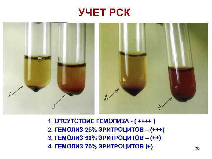 Посттрансфузионный гемолиз