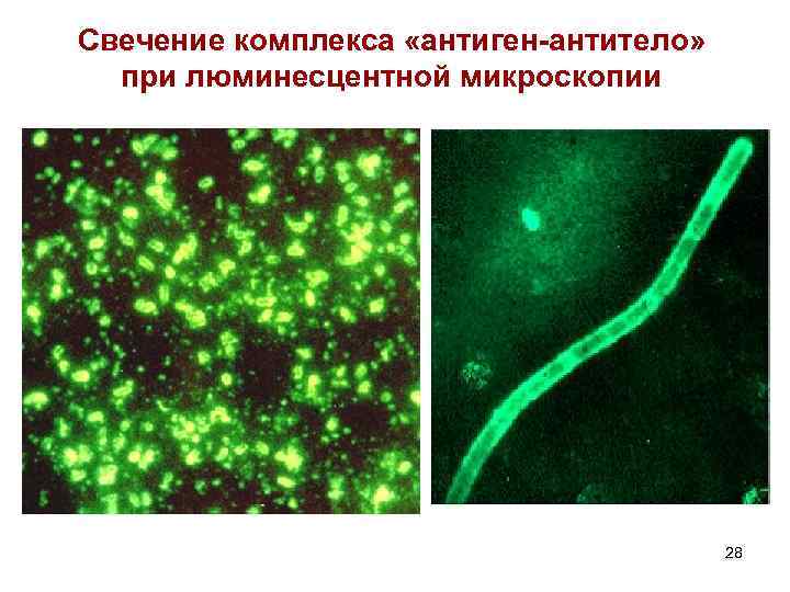 Свечение комплекса «антиген антитело» при люминесцентной микроскопии 28 