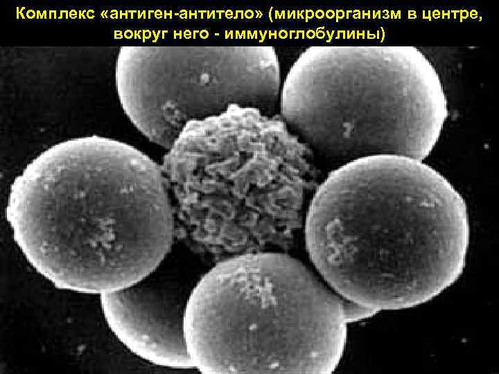 Комплекс «антиген антитело» (микроорганизм в центре, вокруг него иммуноглобулины) 7 