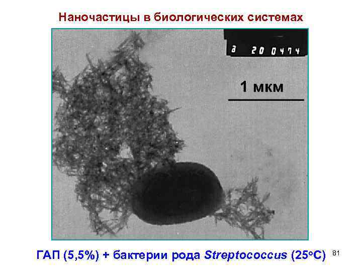 Наночастицы в биологических системах ГАП (5, 5%) + бактерии рода Streptococcus (25 о. С)