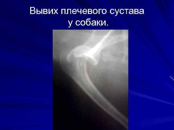 Вывих плечевого сустава у собаки. 