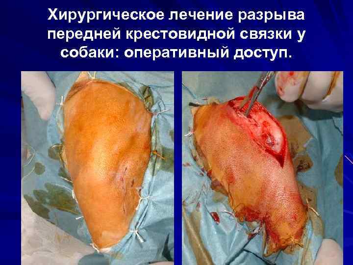 Хирургическое лечение разрыва передней крестовидной связки у собаки: оперативный доступ. 