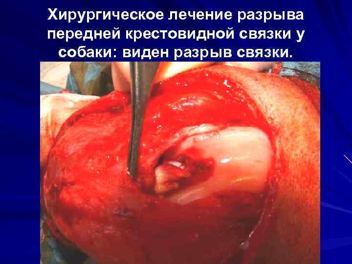 Хирургическое лечение разрыва передней крестовидной связки у собаки: виден разрыв связки. 