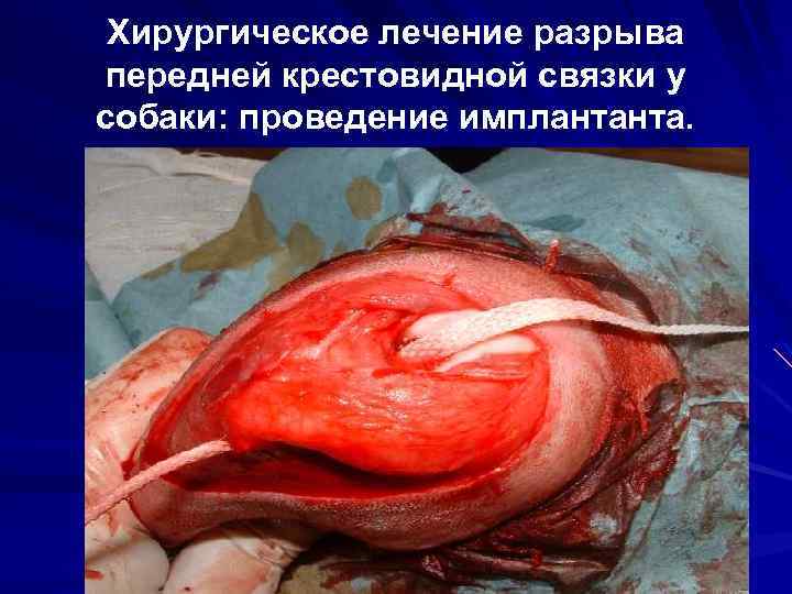 Хирургическое лечение разрыва передней крестовидной связки у собаки: проведение имплантанта. 