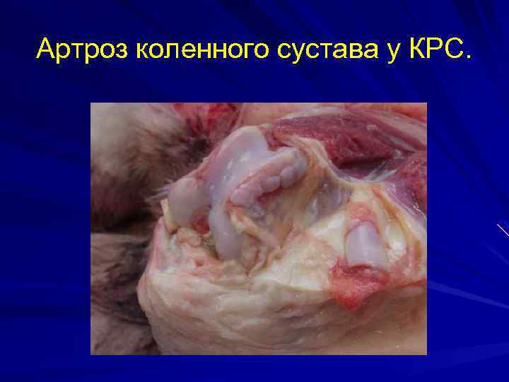 Артроз коленного сустава у КРС. 