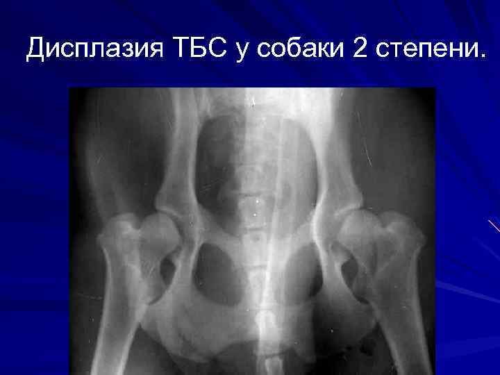 Дисплазия ТБС у собаки 2 степени. 