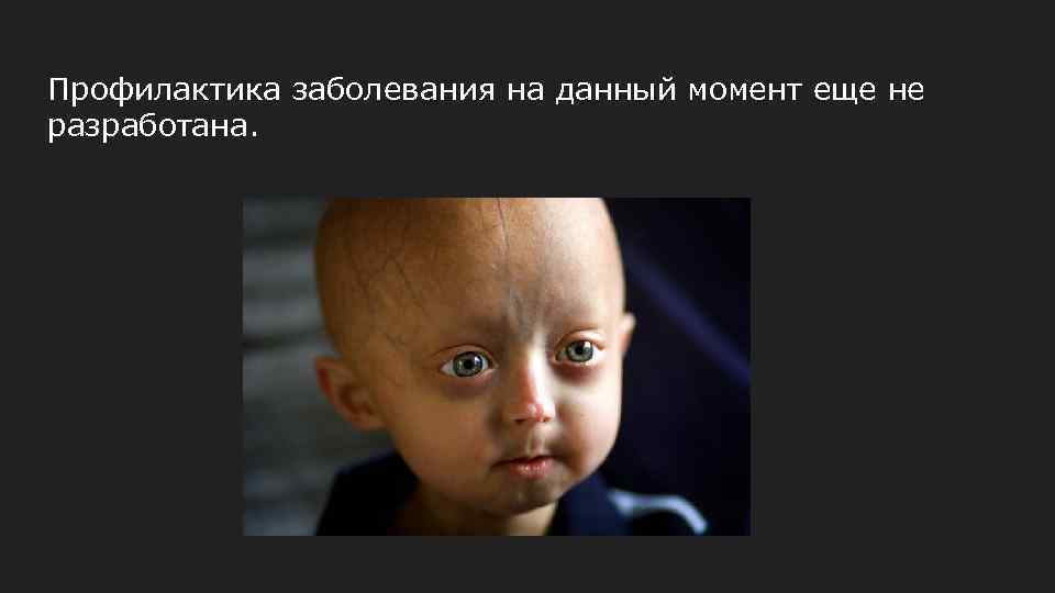 Профилактика заболевания на данный момент еще не разработана. 