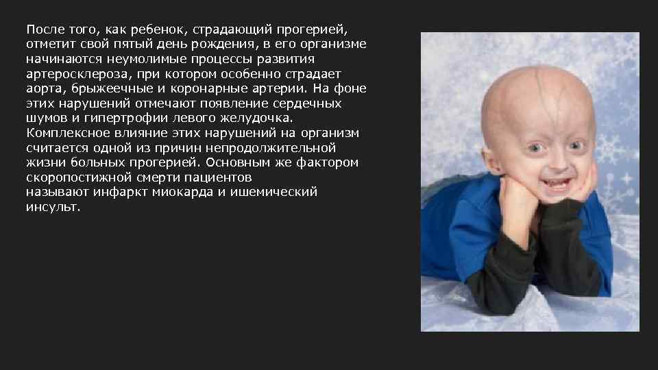 После того, как ребенок, страдающий прогерией, отметит свой пятый день рождения, в его организме