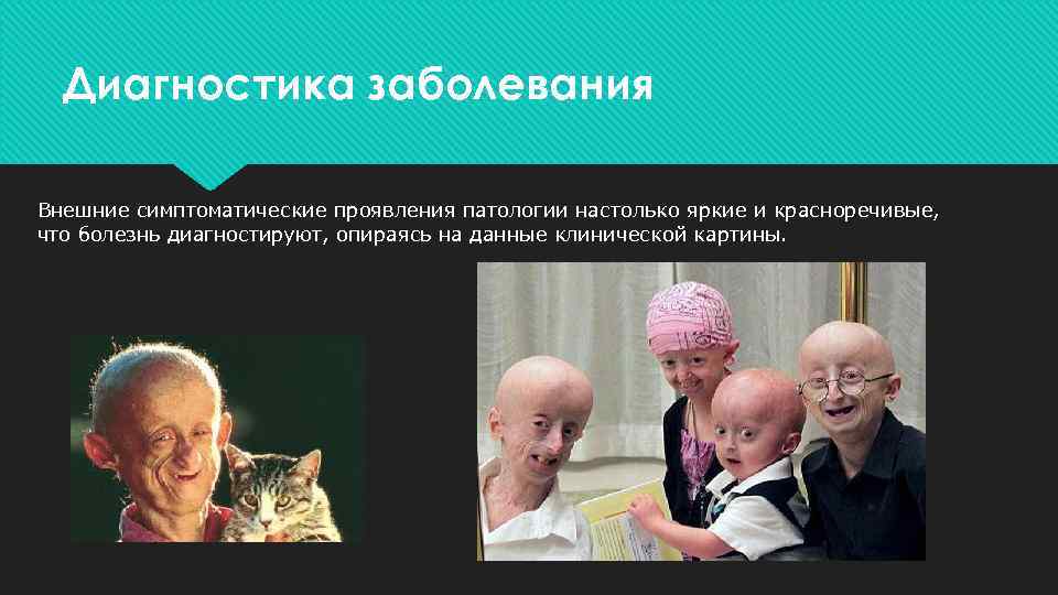 Диагностика заболевания Внешние симптоматические проявления патологии настолько яркие и красноречивые, что болезнь диагностируют, опираясь