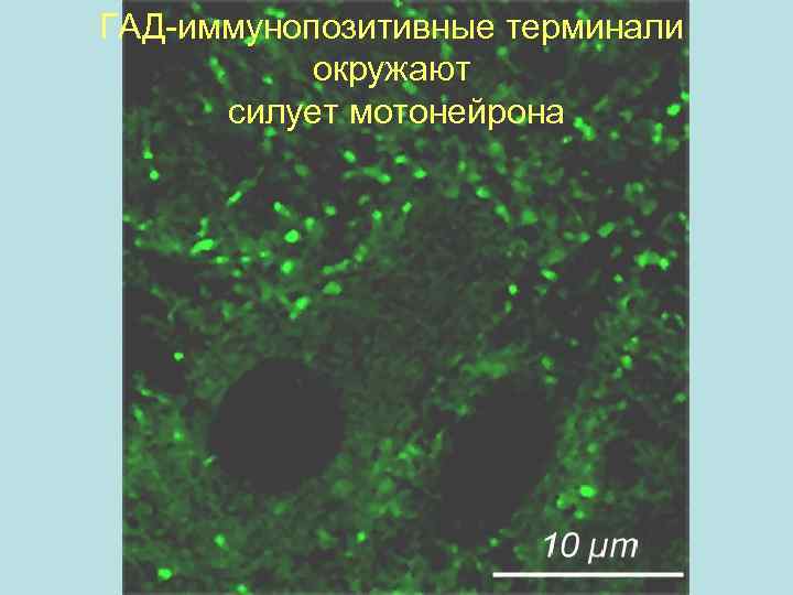 ГАД-иммунопозитивные терминали окружают Гад-терминали (конф) силует мотонейрона 